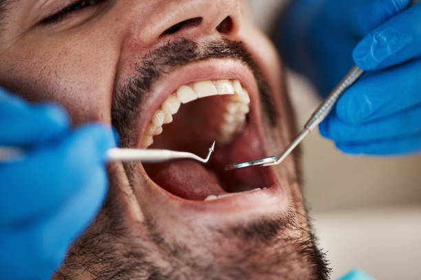 Best Dentist for Tooth Abscess  in Berkley, MI